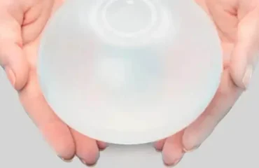 balon-gastrico-como-es como es un balon gastrico