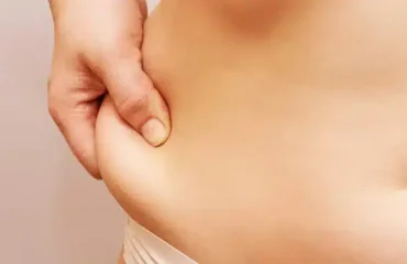 quitar los rollitos con hidrolipoclasia