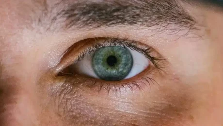 Blefaroplastia sin cirugía