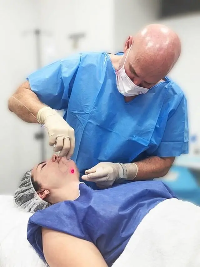 Endolift-Facial-2
