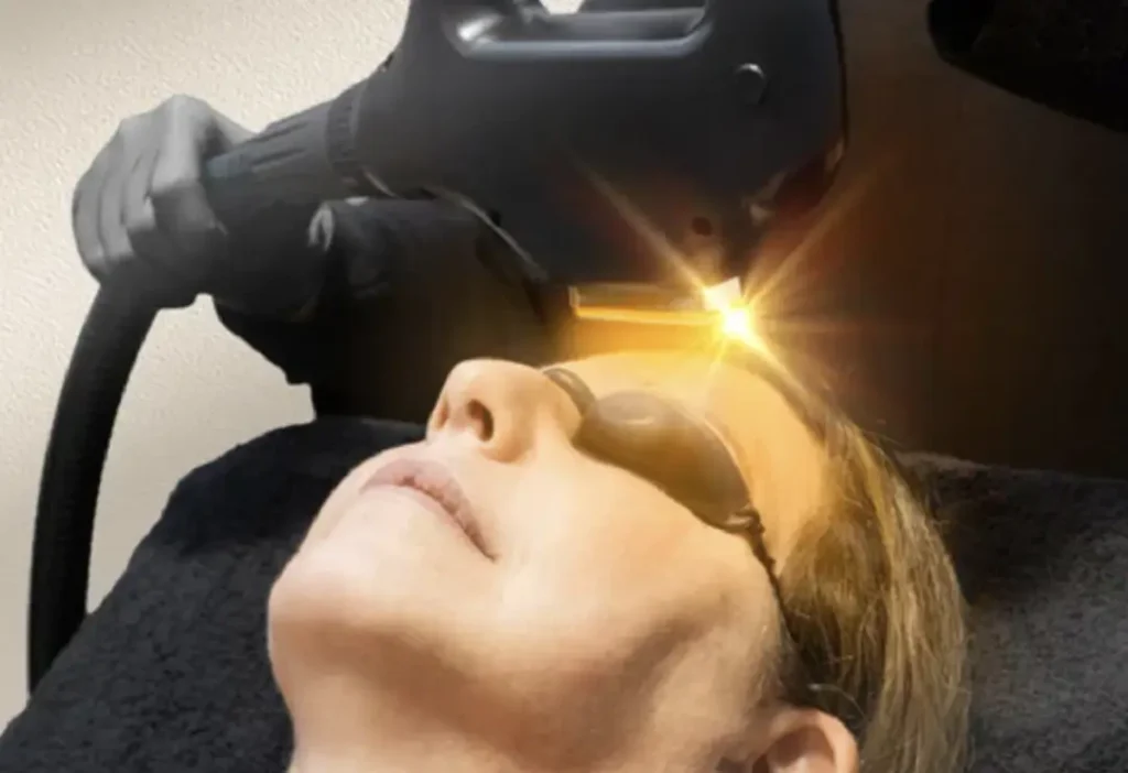 Tratamiento FHOS Facial